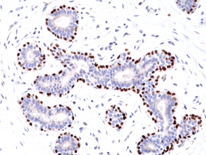 Immunohistochemical
