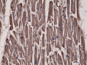 Immunohistochemical