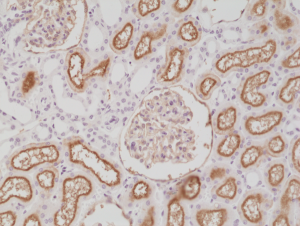 Immunohistochemical