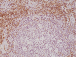 Immunohistochemical