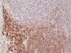 Immunohistochemical