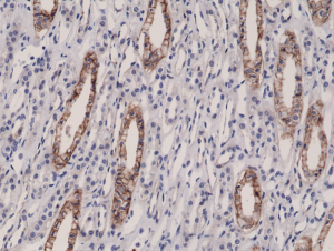 Immunohistochemical