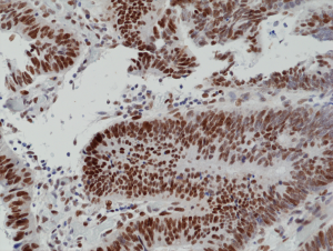 Immunohistochemical