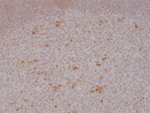 Immunohistochemical
