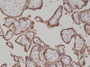 Immunohistochemical