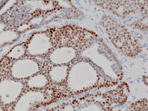Immunohistochemical