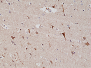 Immunohistochemical
