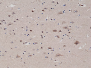 Immunohistochemical
