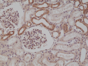 Immunohistochemical