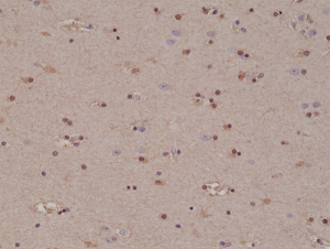 Immunohistochemical