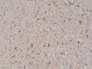 Immunohistochemical