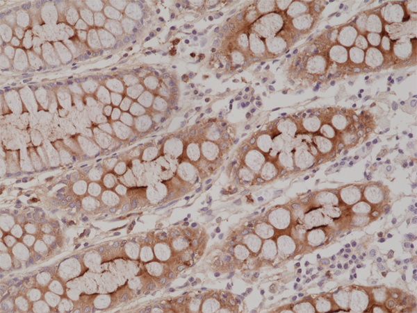 Anti-CEA (Carcinoembryonic Antigen) (CD66e) Rabbit Monoclonal Antibody [Clone RM326], 31-1213-00