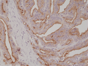 Immunohistochemical