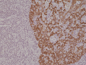 Immunohistochemical