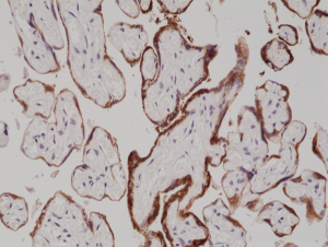 Immunohistochemical