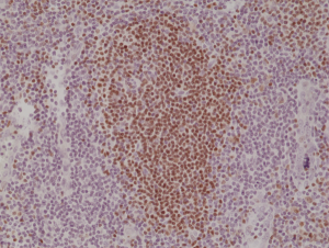 Immunohistochemical