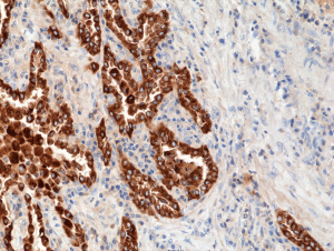 Immunohistochemical