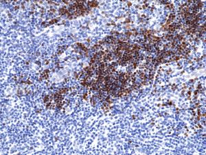 Immunohistochemical