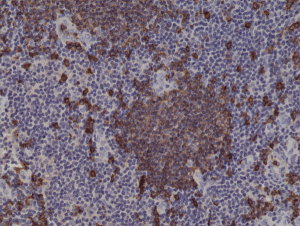Immunohistochemical