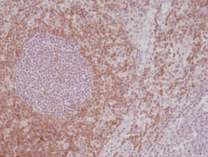 Immunohistochemical