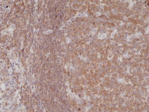 Immunohistochemical