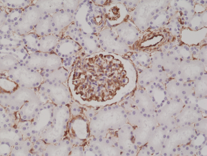 Immunohistochemical