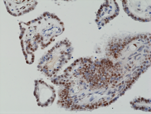Immunohistochemical