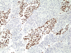 Immunohistochemical