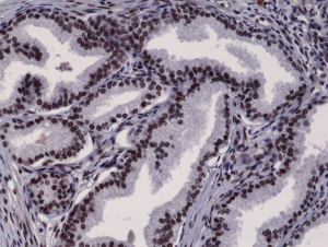 Immunohistochemical