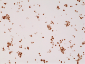 Immunohistochemical