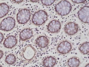 Immunohistochemical