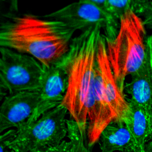 Immunocytochemistry