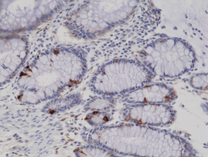 Immunohistochemical