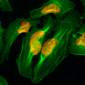 Immunocytochemistry
