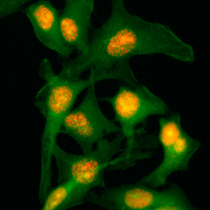 Immunocytochemical
