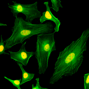 Immunocytochemistry