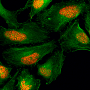Immunocytochemistry