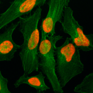 Immunocytochemistry