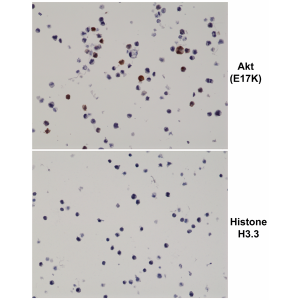 Immunohistochemical