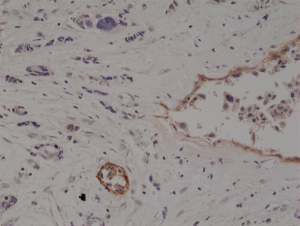 Immunohistochemical