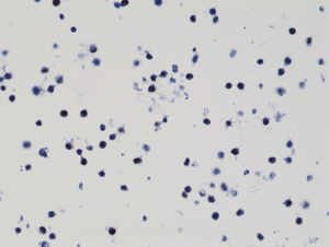 Immunohistochemical