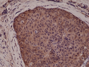 Immunohistochemical
