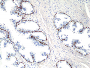 Immunohistochemical