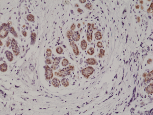 Immunohistochemical