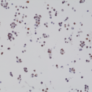 Immunohistochemical