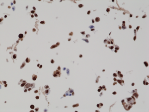 Immunohistochemical