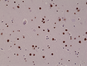 Immunohistochemical