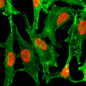 Immunocytochemistry