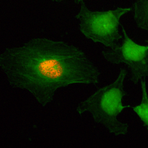 Immunocytochemistry