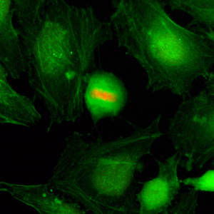 Immunocytochemistry